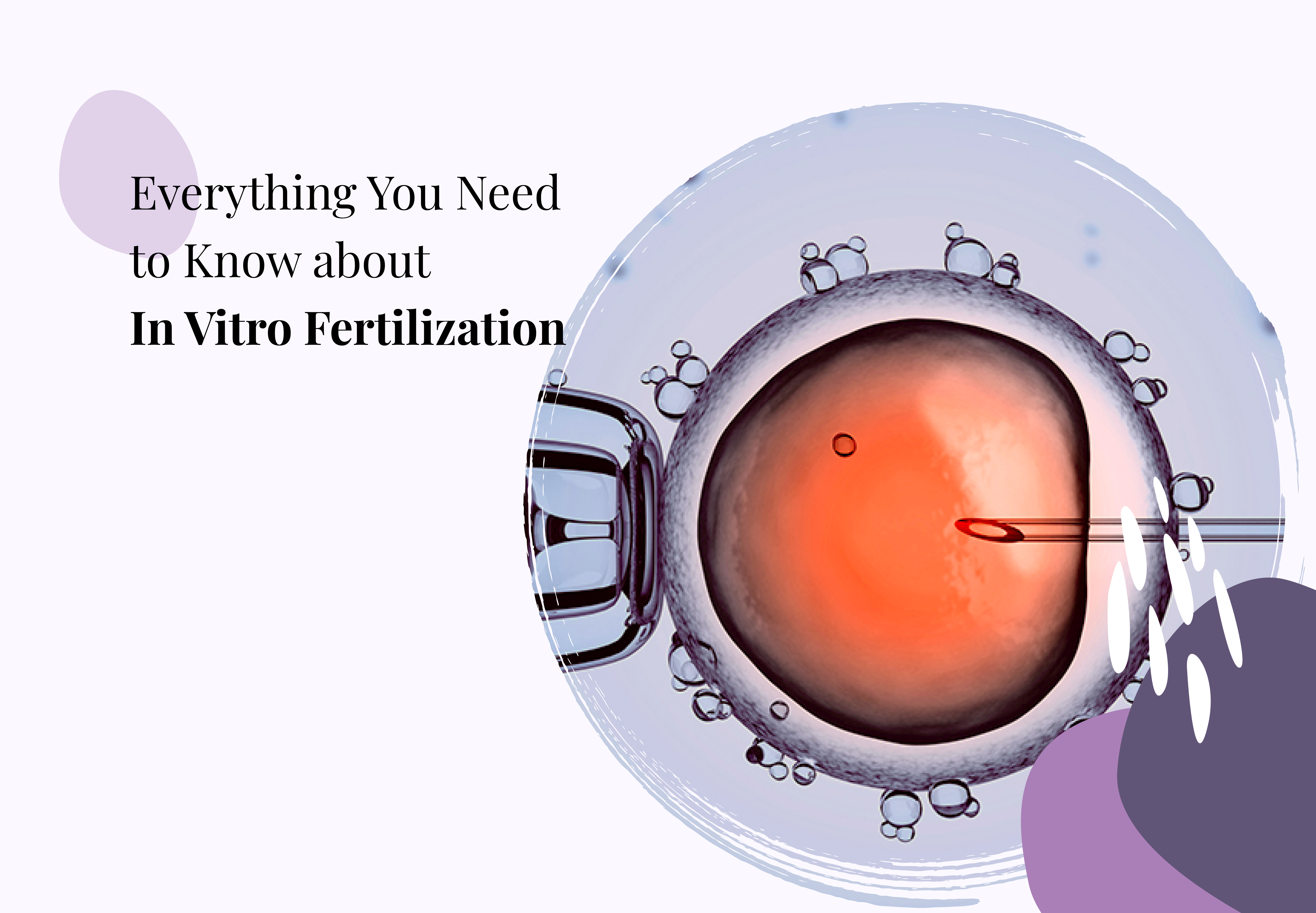 Everything You Need To Know About IVF
