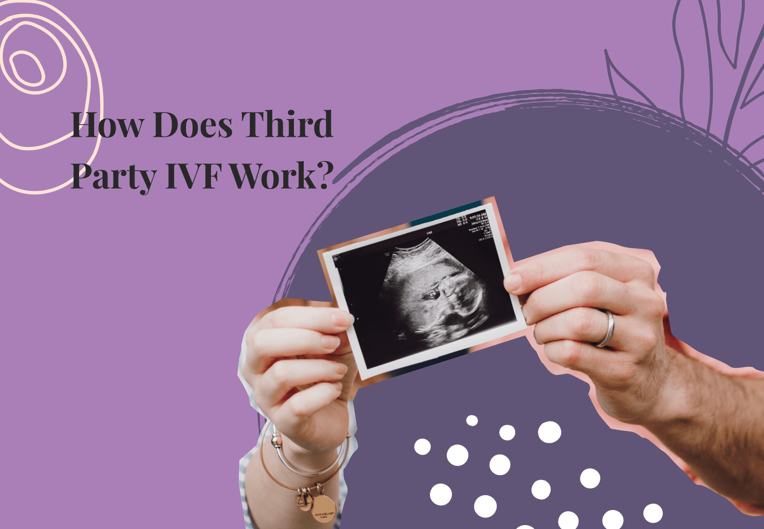 How Does Third-Party IVF Work?